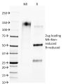 CTLA4 / CD152 (Negative Regulator of T-Cells)(L4P2F5.F10), 0.2mg/mL