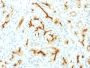 CFTR (Cystic Fibrosis Transmembrane Conductance Regulator) (CFTR/1775R), 0.2mg/mL