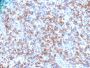 CD8A (Cytotoxic- & Suppressor T-Cell Marker)(N/A), 0.2mg/mL