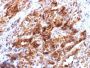 Glypican-3 (GPC3) (Hepatocellular Carcinoma Marker) (rGPC3/863), 0.2mg/mL