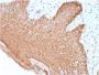 Cytokeratin, Multi (Epithelial Marker)(rKRT/457), 0.2mg/mL
