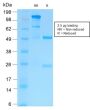 MMP9 (MMP9/2025R), 0.2mg/mL