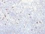 Human IgG4 (Ig Heavy Constant Gamma 4) (G4m Marker) (IGHG4/2042R), 0.2mg/mL