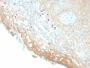 HPV-16 (Human Papilloma Virus 16)(HPV16/2058R), 0.2mg/mL