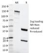 MSH6 (DNA Mismatch Repair Protein) (MSH6/2111), 0.2mg/mL