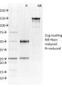 PU.1 (SPI-1) (B-Cell Marker) (PU1/2146), 0.2mg/mL