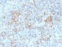 PU.1 (SPI-1) (B-Cell Marker) (PU1/2146), 0.2mg/mL