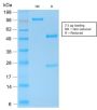 E-Cadherin (CDH1) / CD324 (Intercellular Junction Marker) (CDH1/2208R), 0.2mg/mL