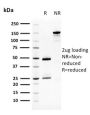 Squamous Cell Carcinoma Antigen 1(CPTC-SERPINB3-2), 0.2mg/mL