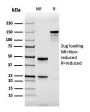 Calbindin 1 (CALB1)(CALB1/2364), 0.2mg/mL