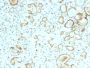 STAT6 (Solitary Fibrous Tumor Marker)(STAT6/2410), 0.2mg/mL