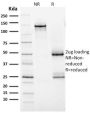 HER-2 / c-erbB-2 / neu / CD340 (ERBB2/2452), 0.2mg/mL