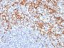 MMP9 (Matrix Metalloproteinase 9)(MMP9/2477), 0.2mg/mL