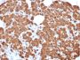 Carboxypeptidase A1 / CPA1 (Pancreatic Cancer Marker)(CPA1/2711), 0.2mg/mL