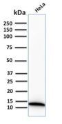S100A4 (Marker of Tumor Metastasis) (S100A4/2750R), 0.2mg/mL