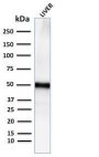 Adipophilin / Perilipin-2 (Marker of Lipid Accumulation) (ADFP/2755R), 0.2mg/mL