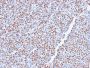 ALK (Anaplastic Lymphoma Kinase) / CD246(ALK1/2766R), 0.2mg/mL