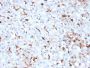 Cathepsin K (Marker of Tumor Invasiveness)(CTSK/2793), 0.2mg/mL