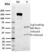Band III(Q1/156), 0.2mg/mL