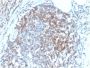 CD6 (Negative Marker of T-regulatory Cells) (C6/2884R), 0.2mg/mL
