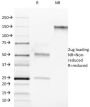 ROR-gamma / RORC (RAR-related Orphan Receptor C)(RORC/2942), 0.2mg/mL