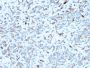 C1QA / Complement C1q A-Chain(C1QA/2952), 0.2mg/mL