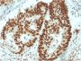 MSH6 (DNA Mismatch Repair Protein)(MSH6/3091), 0.2mg/mL