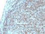 CD74 (B-Cell Marker)(CLIP/3127R), 0.2mg/mL