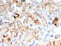 S100A4 / Metastasin / Calvasculin (Marker of Tumor Metastasis)(rS100A4/1481), 0.2mg/mL