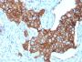 HER-2 / c-erbB-2 / neu / CD340(ERBB2/3257), 0.2mg/mL