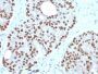 NKX3.1 (Metastatic Prostate Adenocarcinoma Marker)(NKX3.1/3350), 0.2mg/mL