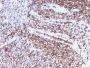 CD44 / HCAM Std. (Cancer Stem Cell Marker)(rHCAM/918), 0.2mg/mL
