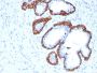 Cytokeratin 5 (KRT5) (Basal, Myoepithelial & Mesothelial Cell Marker)(KRT5/3594), 0.2mg/mL