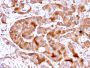 FABP5 (Marker of Metastatic Potential in Colorectal Cancer)(FABP5/3750), 0.2mg/mL