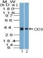 Cytokeratin 19(A53-B/A2.26), 1mg/mL