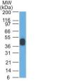 Cytokeratin, LMW(AE-1), 1mg/mL