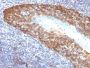 Cytokeratin 14(KRT14/532), 1mg/mL