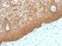 Cytokeratin 14(KRT14/532), 1mg/mL