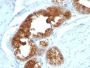 TAG-72 / CA72.4(B72.3 + CA72/733), 1mg/mL