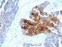 TAG-72 / CA72.4(B72.3 + CA72/733), 1mg/mL