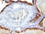 Cytokeratin 7(KRT7/760), 1mg/mL