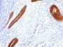 Cytokeratin 7(KRT7/760), 1mg/mL