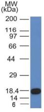 CD117(KIT/982), 1mg/mL