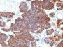 PTH / Parathyroid Hormone (N-Terminal)(PTH/1174), 1mg/mL