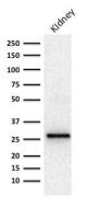 Adiponectin (Marker of Obesity) (ADPN/1370), 1mg/mL