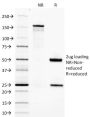Adiponectin (Marker of Obesity) (ADPN/1370), 1mg/mL