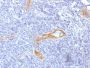 von Willebrand Factor / Factor VIII Related-Ag (Endothelial Marker)(rVWF/1465), 1mg/mL