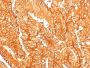 Ep-CAM / CD326 (Epithelial Marker) (EGP40/1556R), 1mg/mL