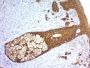 Cytokeratin, Basic (Type II or HMW) (Epithelial Marker) (KRTH/1576R), 1mg/mL