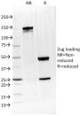 IL-4 / Interleukin 4(IL4/1597), 1mg/mL